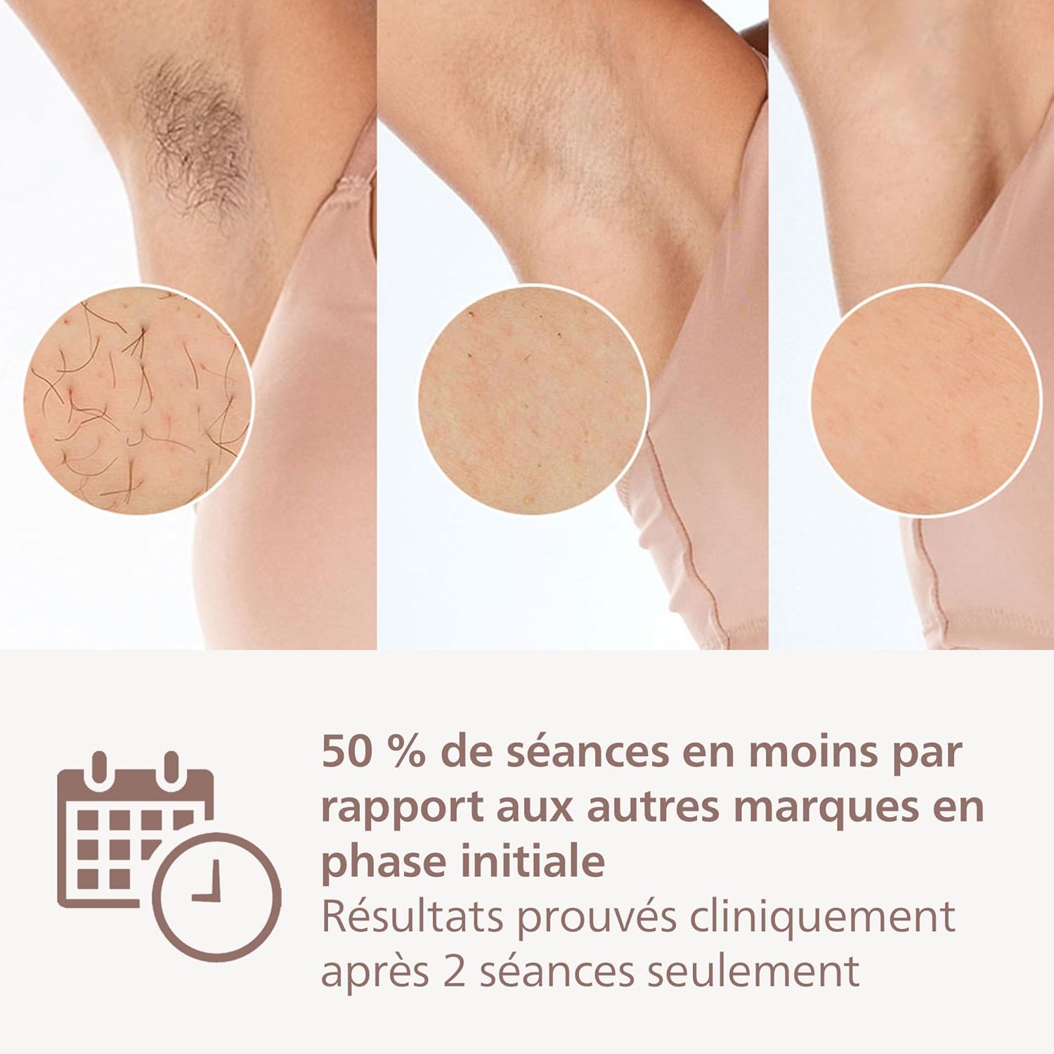 Philips Lumea 9900