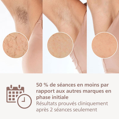 Philips Lumea 9900