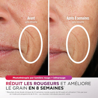 Shark Masque LED Visage Universel – Technologie Dermatologique à Domicile