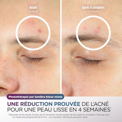 Shark Masque LED Visage Universel – Technologie Dermatologique à Domicile